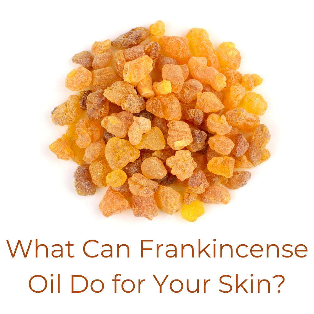 Can You Put Frankincense Directly On Your Skin The Benefits of Frankincense Oil for Your Skin | Sibu Seaberry